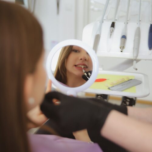 Esteettiset Kerrostusmuovit 7414