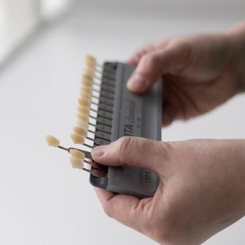 Hammaskruunut 3r1a3893